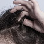chứng nghiện nhổ tóc